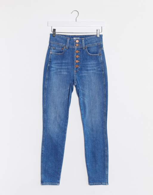 Exposed button store high waisted jeans