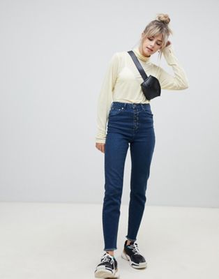 exposed button jeans