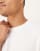 Thumbnail 5 van 5