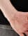 Thumbnail 2 van 3