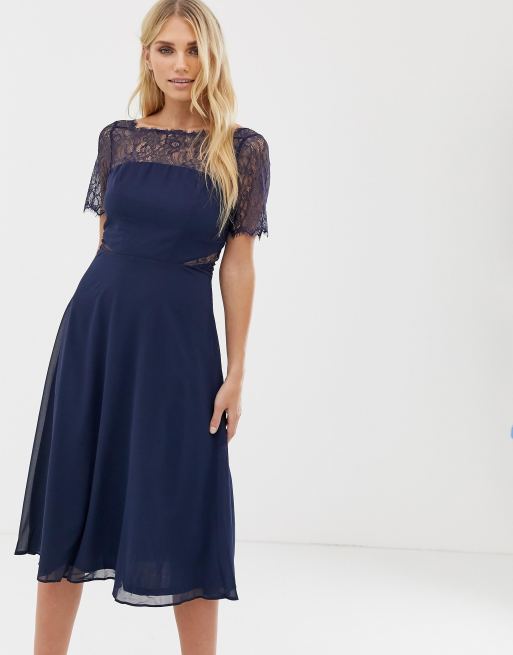  Dress Midi Lace