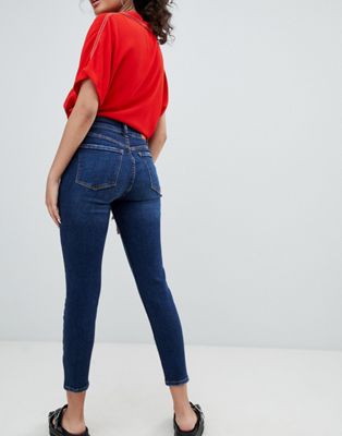 4 button skinny jeans