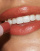 Thumbnail 3 of 4
