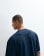 Thumbnail 1 of 5