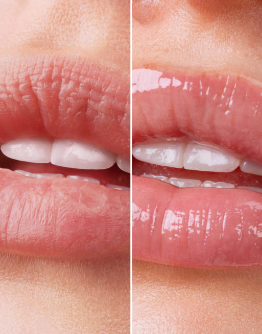 Gisou Honey Glaze Collagen Therapy Lip Mask 15g, 3 of 4