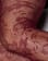 Thumbnail 2 of 3