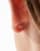 Thumbnail 3 van 3