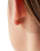 Thumbnail 3 van 3