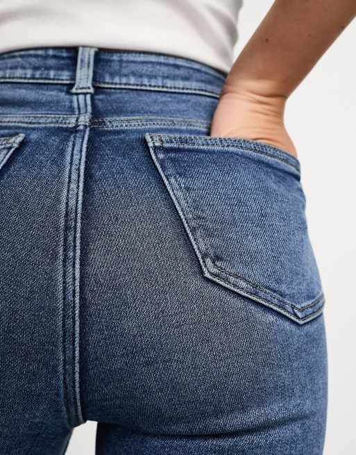 New Look skinny jeans in dark wash blue, 2 of 5