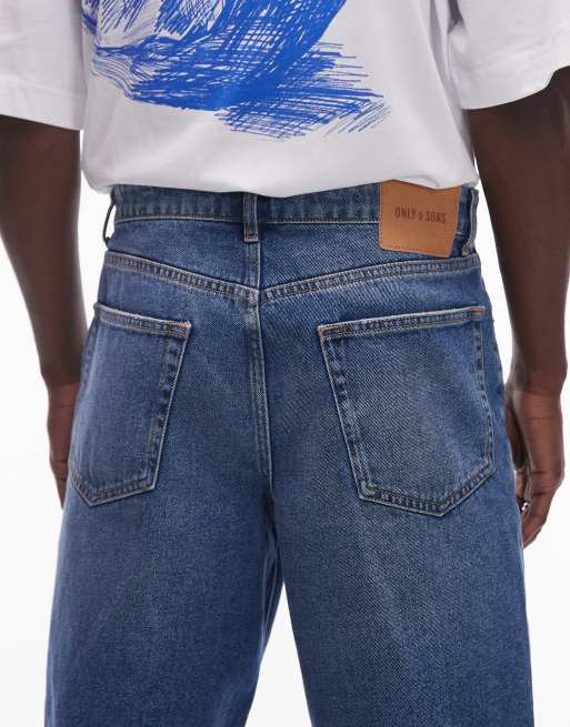 ONLY & SONS fade loose fit denim shorts in mid blue wash, 3 of 5